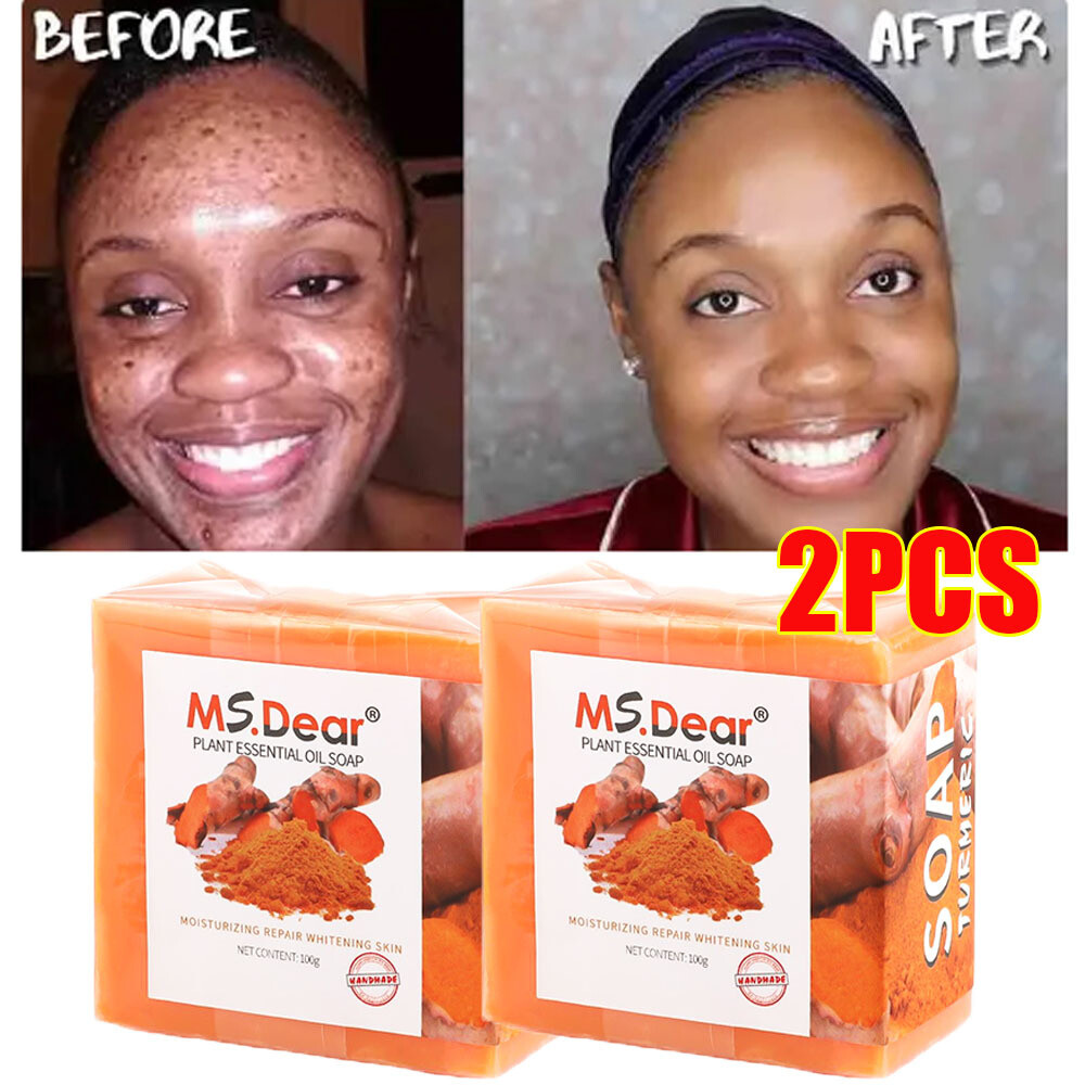 2Pcs Tumeric Soap Skin Whitening Dark Spots lightening Acne Brightening Turmeric