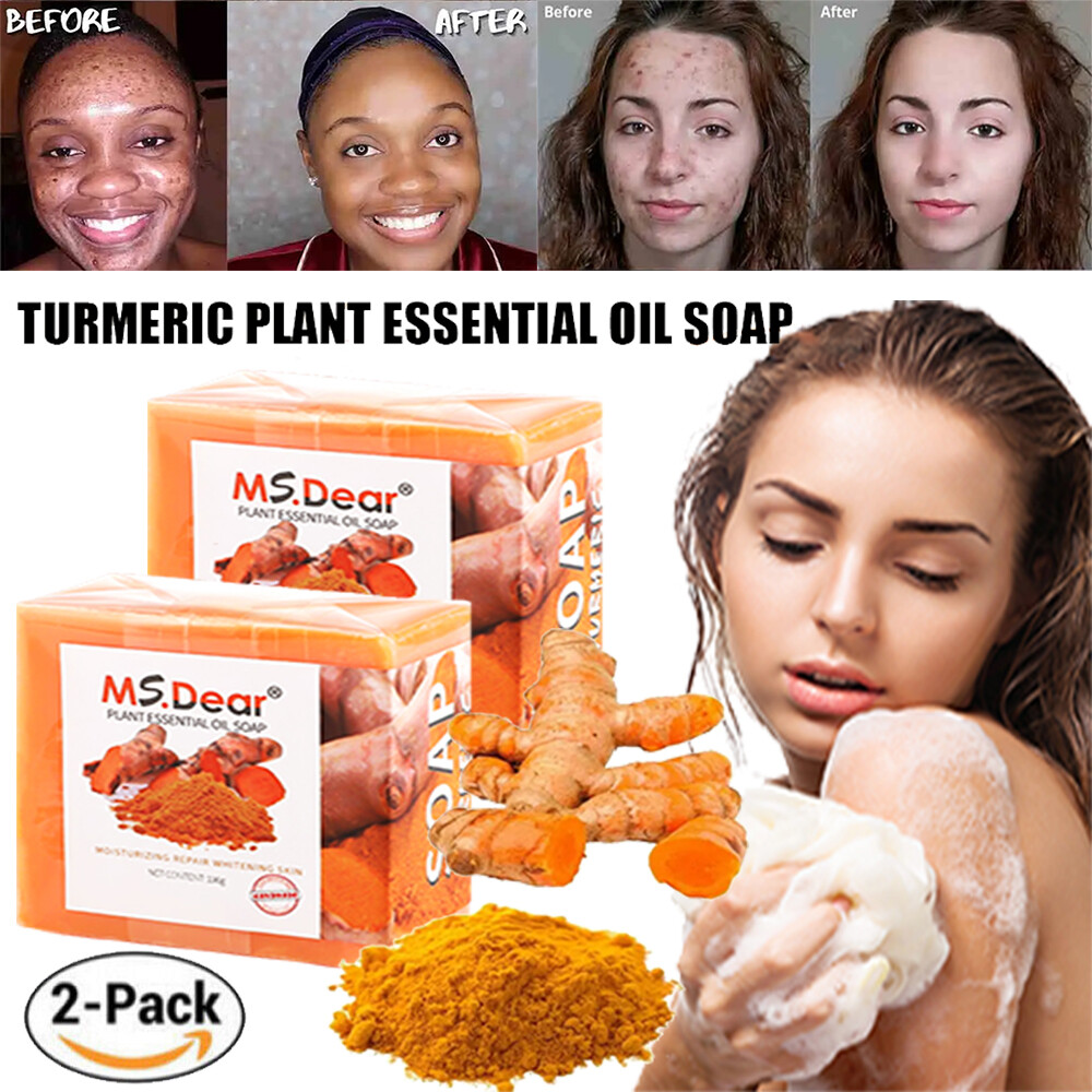 2X Turmeric Soap Bar for Face & Body-Tumeric Soap,Acne, Dark Spots, Smooth Skin