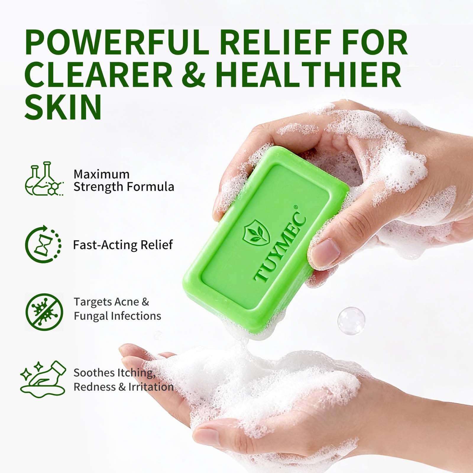 Antifungal Bar Soap – Skin Fungus Treatment for Athlete’s Foot, Jock Itch & R…
