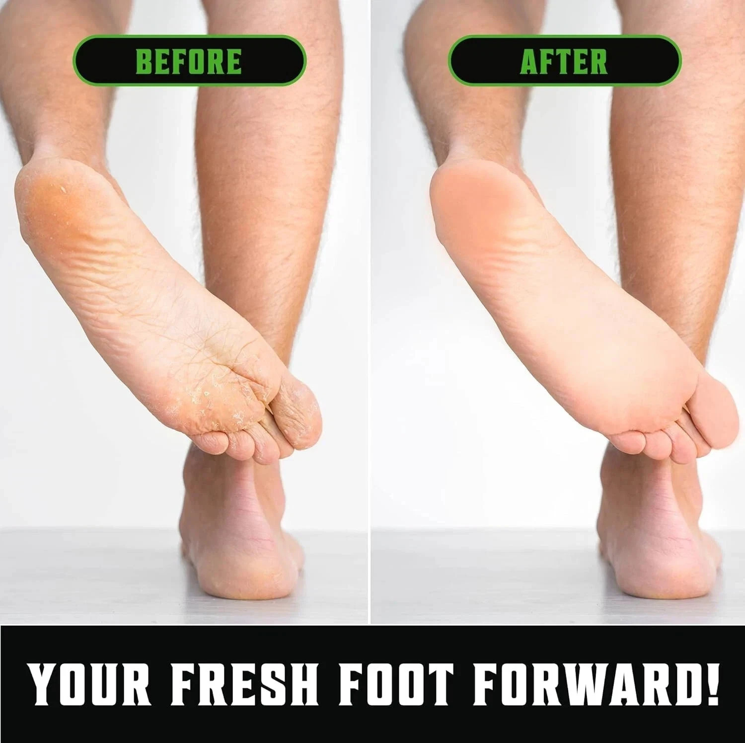 Antifungal Tea Tree Oil Body Wash Soap for Men – Helps Athletes Foot Toenail