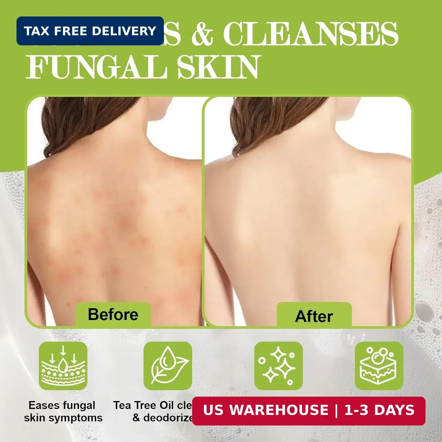 Antifungal Soap-Antibacterial Soap Bar with Tea Tree Oil- Body & Face Wash for A