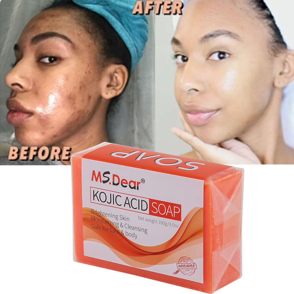 2PCS Kojic Acid Soap Acne Dark Spot Remover Skin Lightening Whitening Face Body
