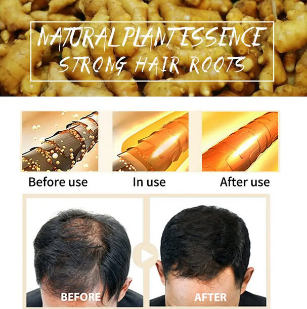 Ginger Hair Regrowth Shampoo Bars – Pack of 2, Promotes Hair Growth, Natural