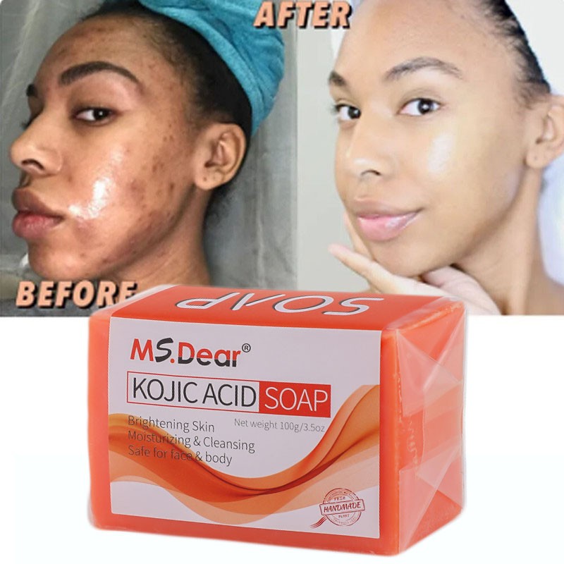 Face & Body Skin Brightening Soap Kojic Acid Soap for Dark Spot Whitening 100g
