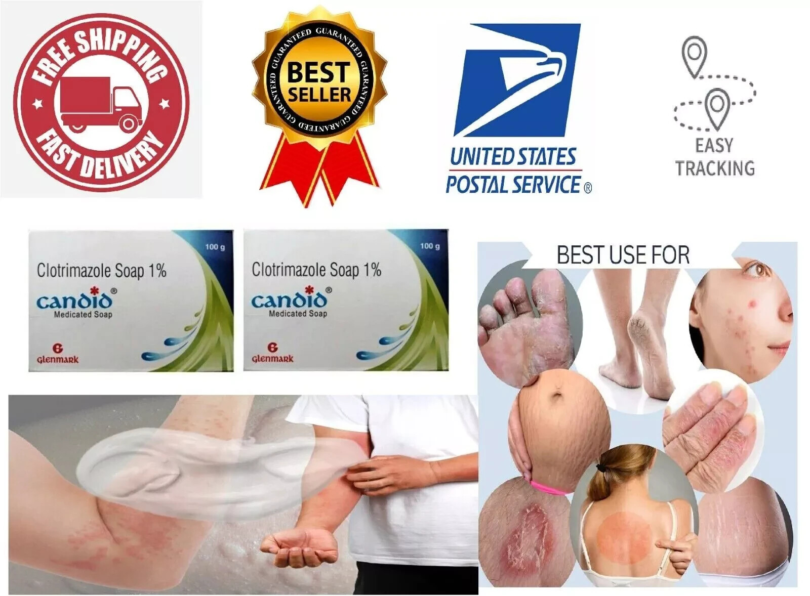 (PACK OF 2) Candid Soap Anti-Fungal Bathing Bar 125gm Each by Glenmark