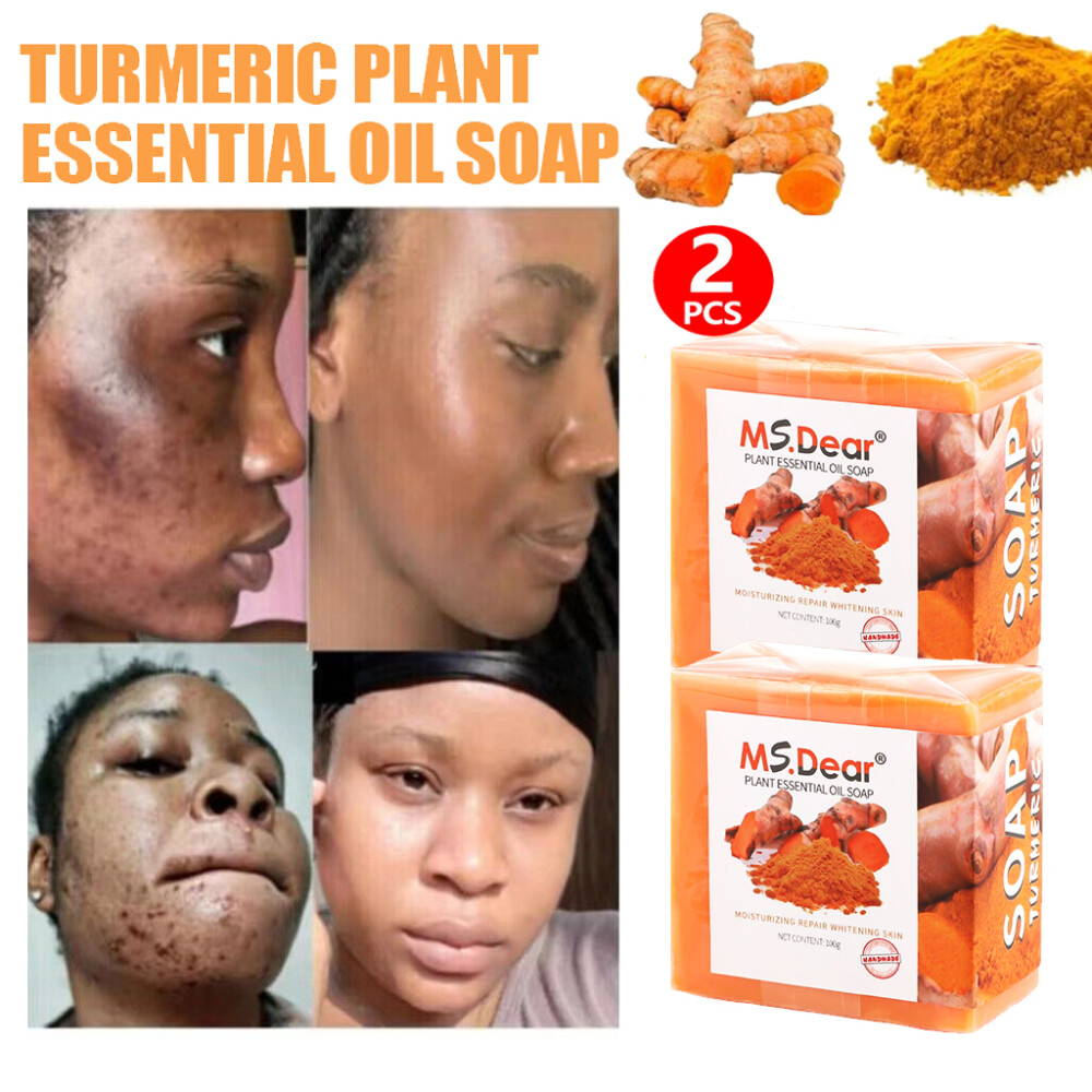 2X Turmeric Soap Bar for Face & Body-Tumeric Soap,Acne, Dark Spots, Smooth Skin