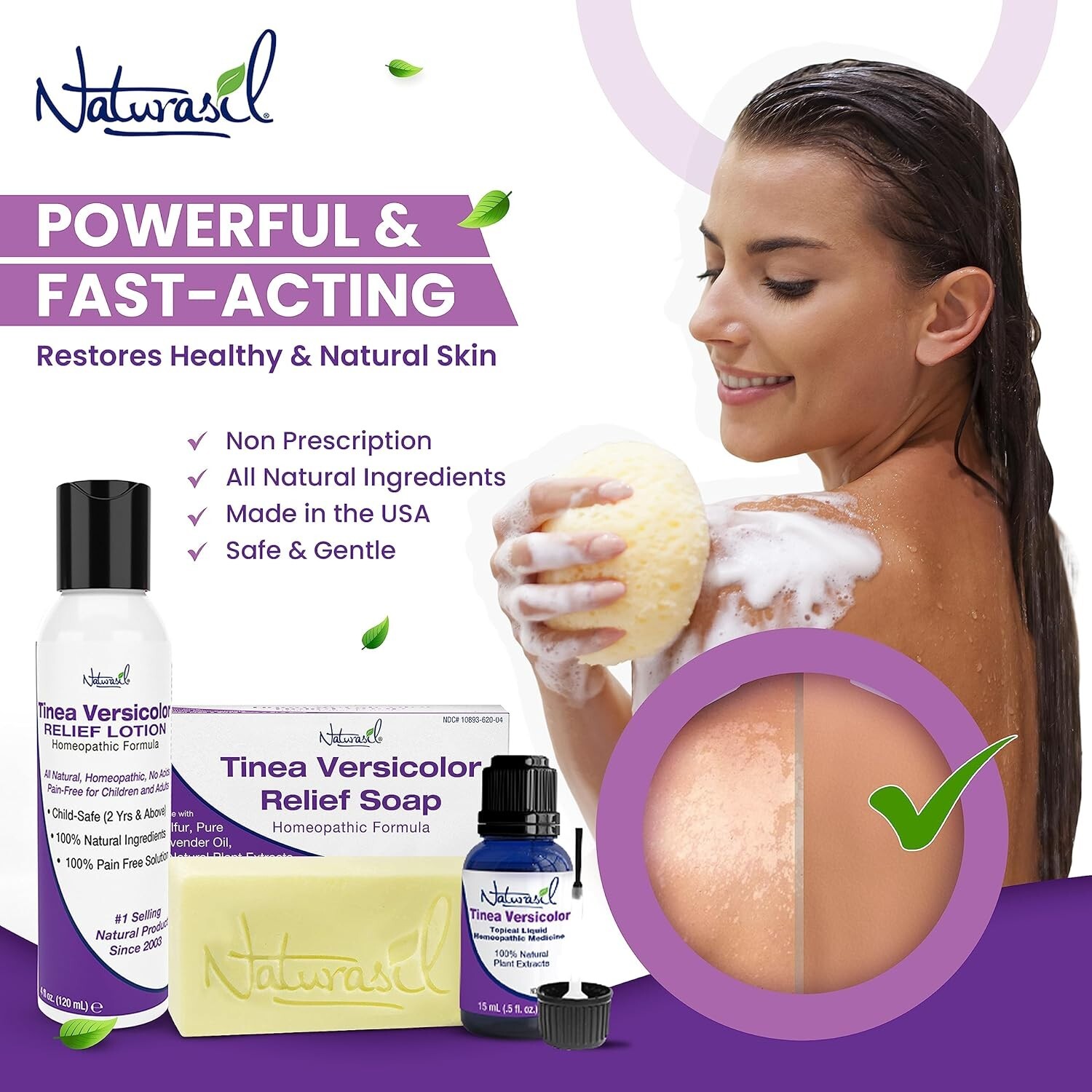 Effective Tinea Versicolor Treatment Max-Strength Soap: Fast-Acting, Kid Safe