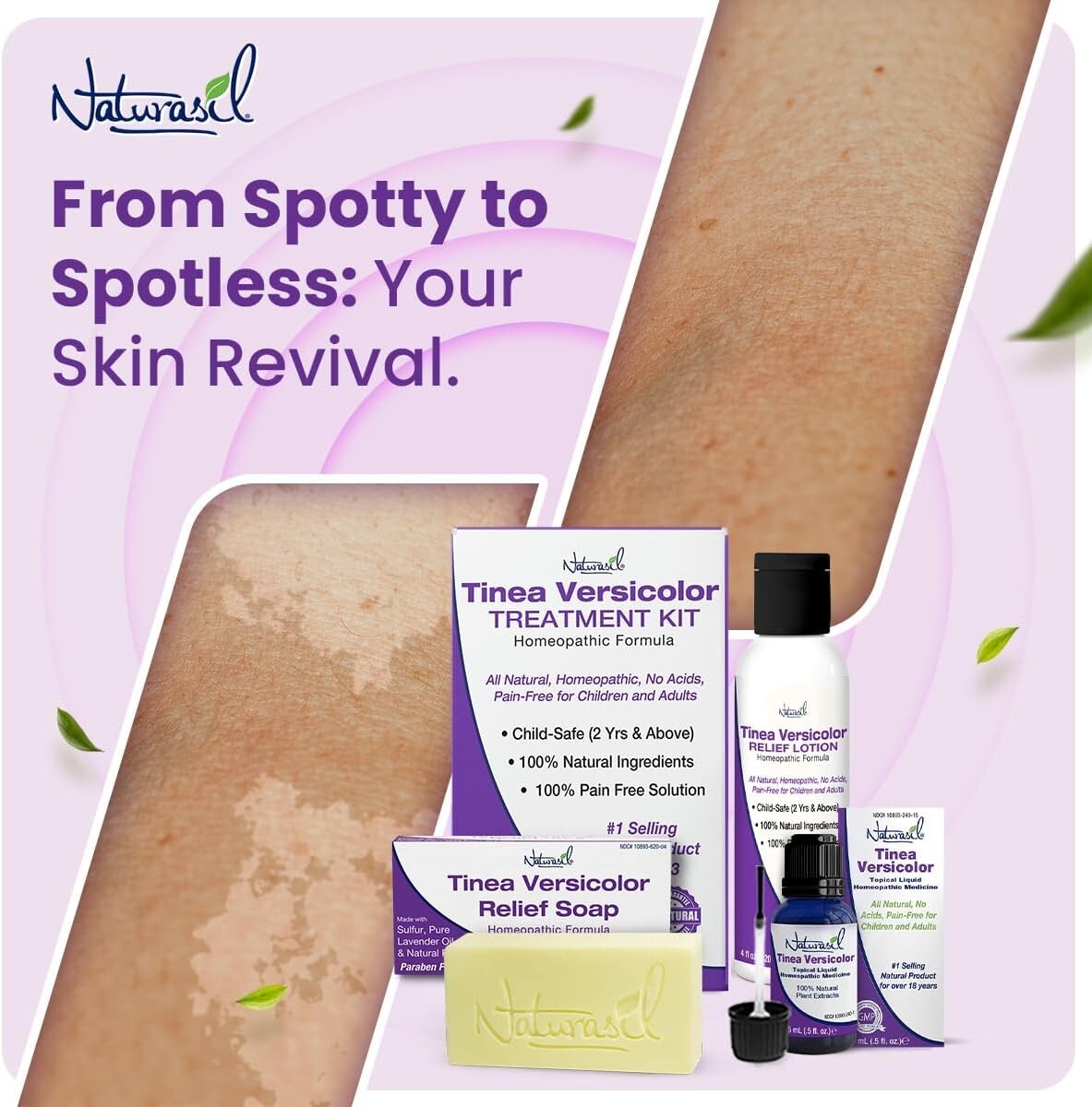 Naturasil Tinea Versicolor Treatment +2 Bars | Max-Strength 10X Soap | Antifunga