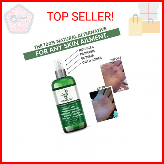 All Natural Eczema Treatment- Psoriasis Treatment – an All-in-One Solution for A