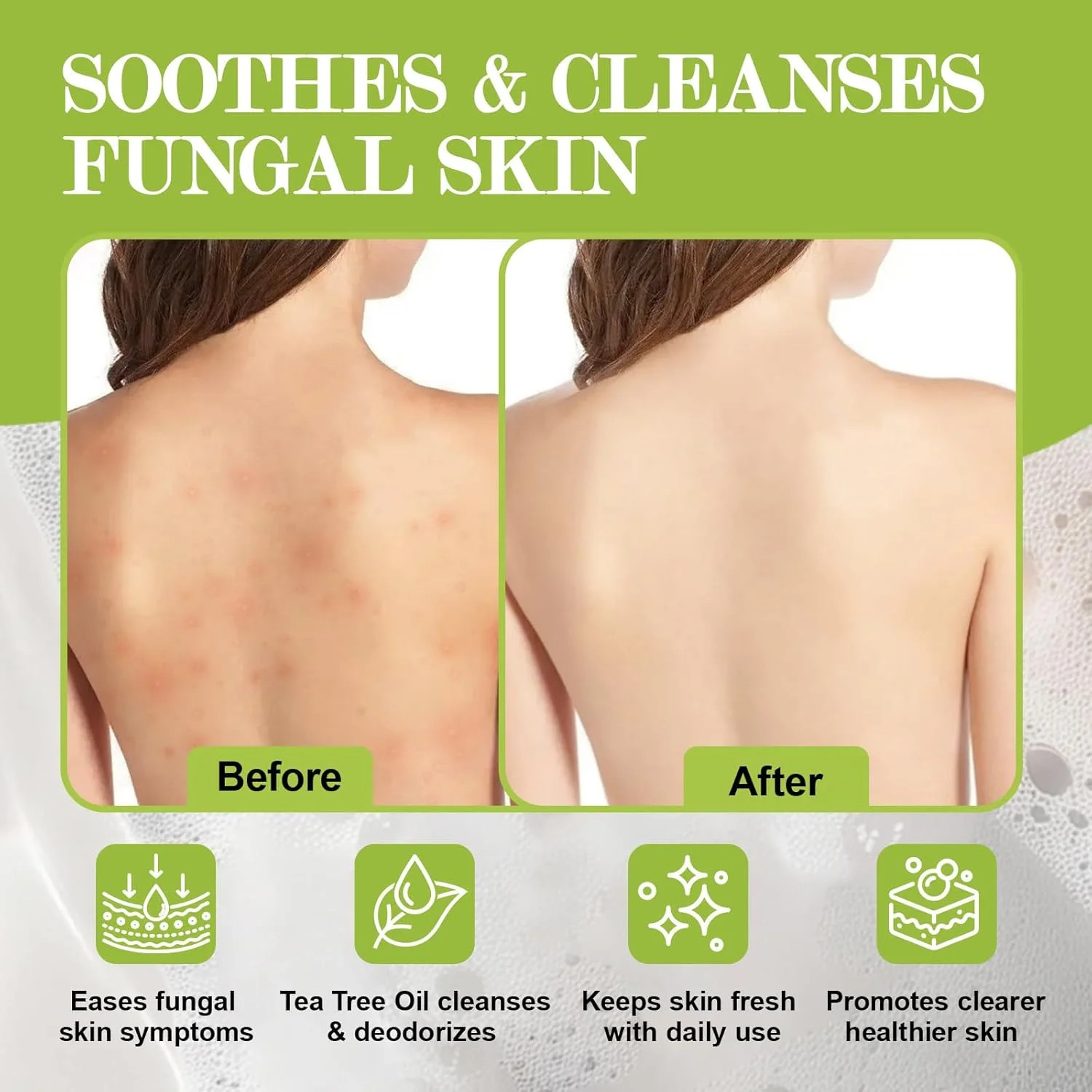 Antifungal Soap-Antibacterial Soap Bar with Tea Tree Oil- Body & Face Wash