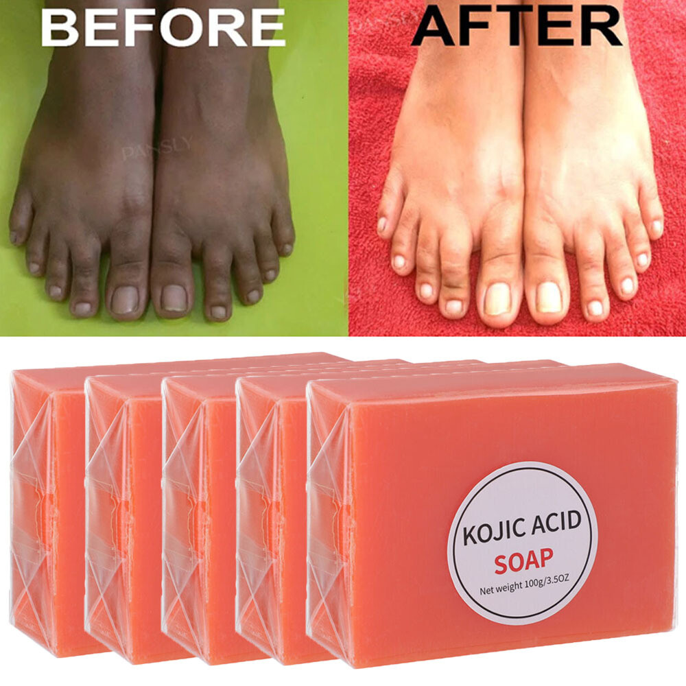 5/3X Kojic Acid Soap Acne Dark Spot Remover Skin Lightening Whitening Face Body