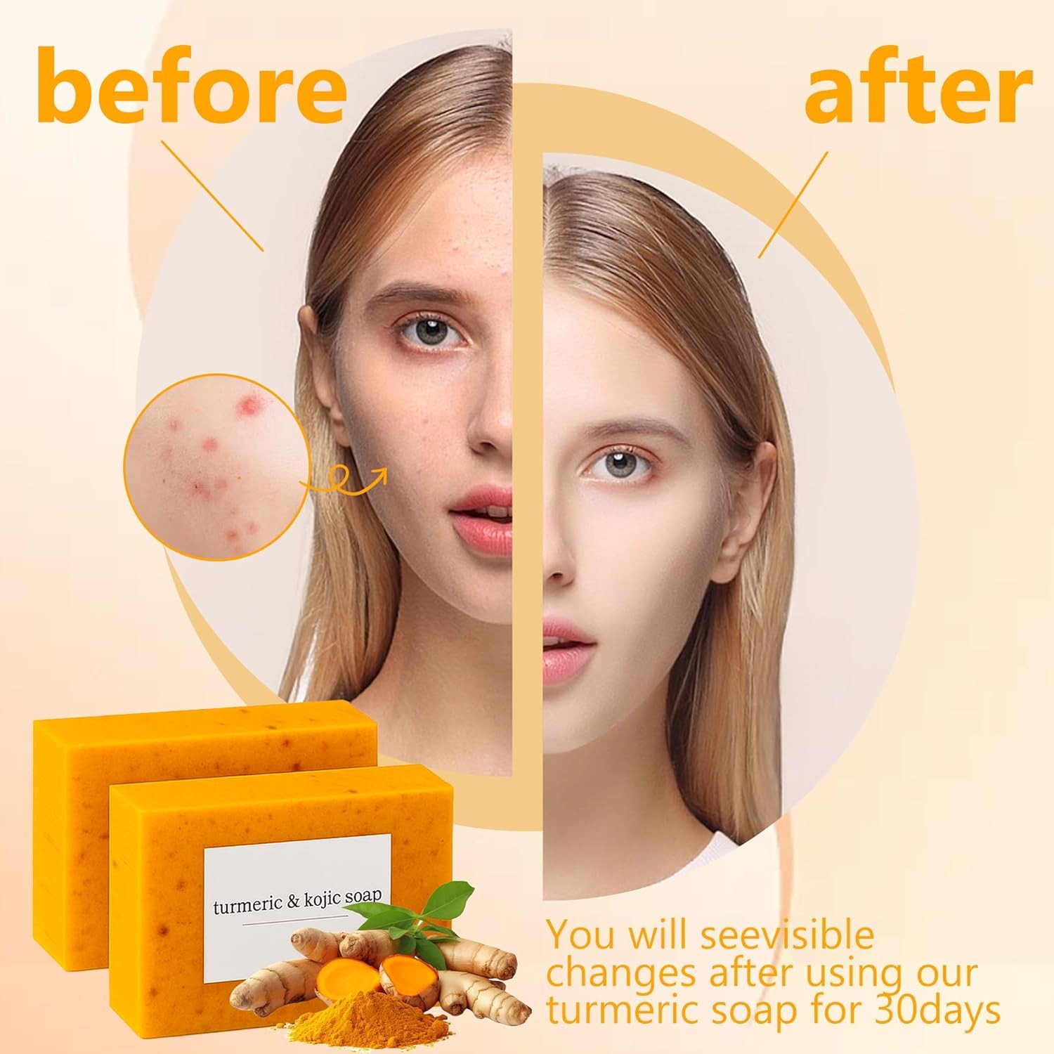 2-Pack Turmeric Glow Soap Bar – Lemon & Kojic Acid, Removing Dark Spots