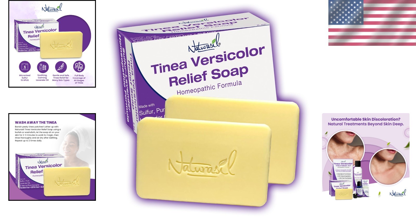 Natural Antifungal Soap for Tinea Versicolor