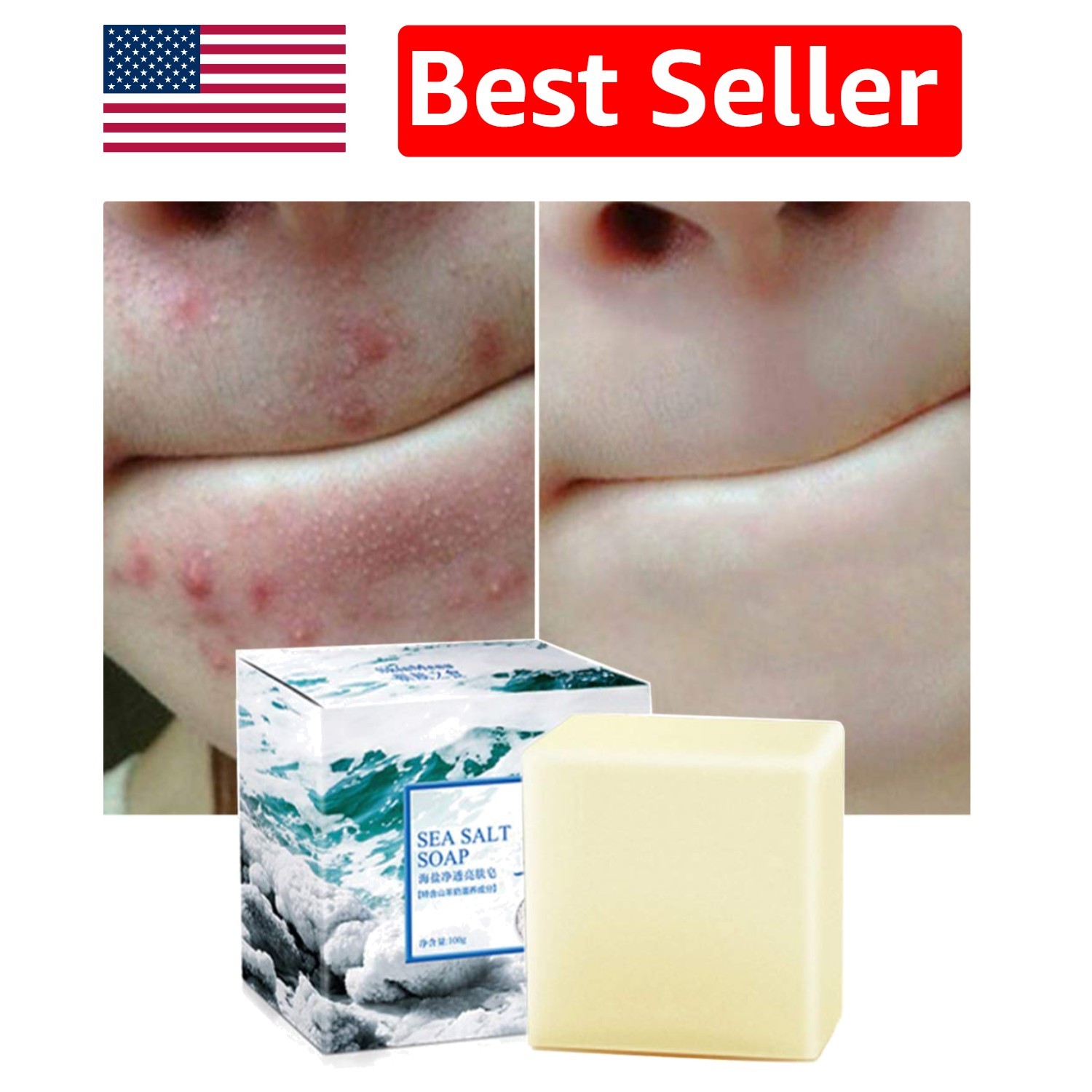 Gentle Exfoliating Sea Salt and Goat Milk Soap for Acne-Prone Skin – 3.52 Oz