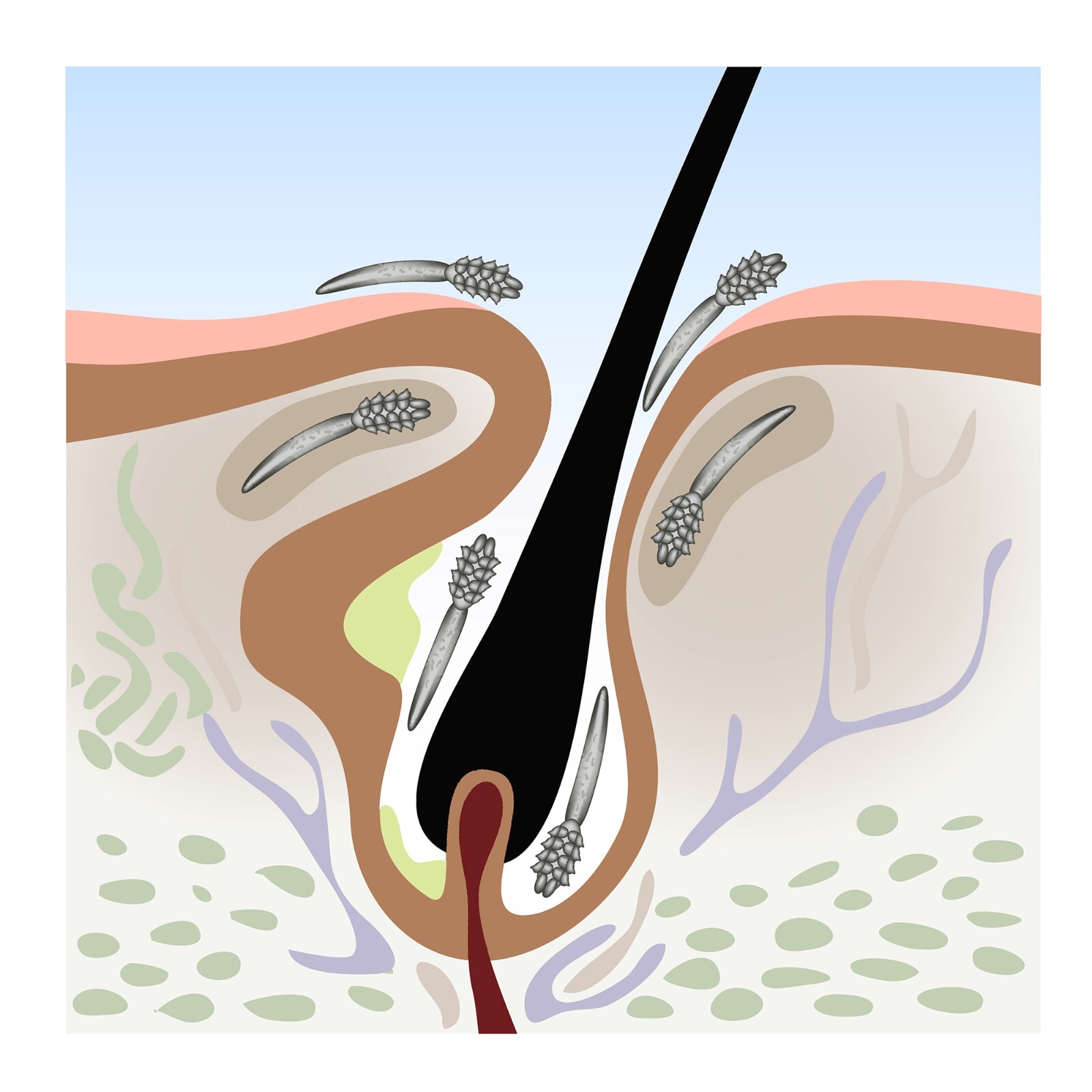 Treat Demodex Acne Rosacea Chalazion Blepharitis | Demodicosis Human Skin Mites