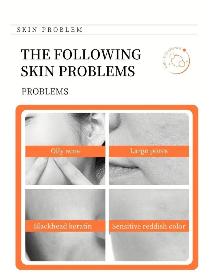 2 Pack Kojic Acid Soap Brighten Skin Tone Fade Dark Spots For All Skin Types