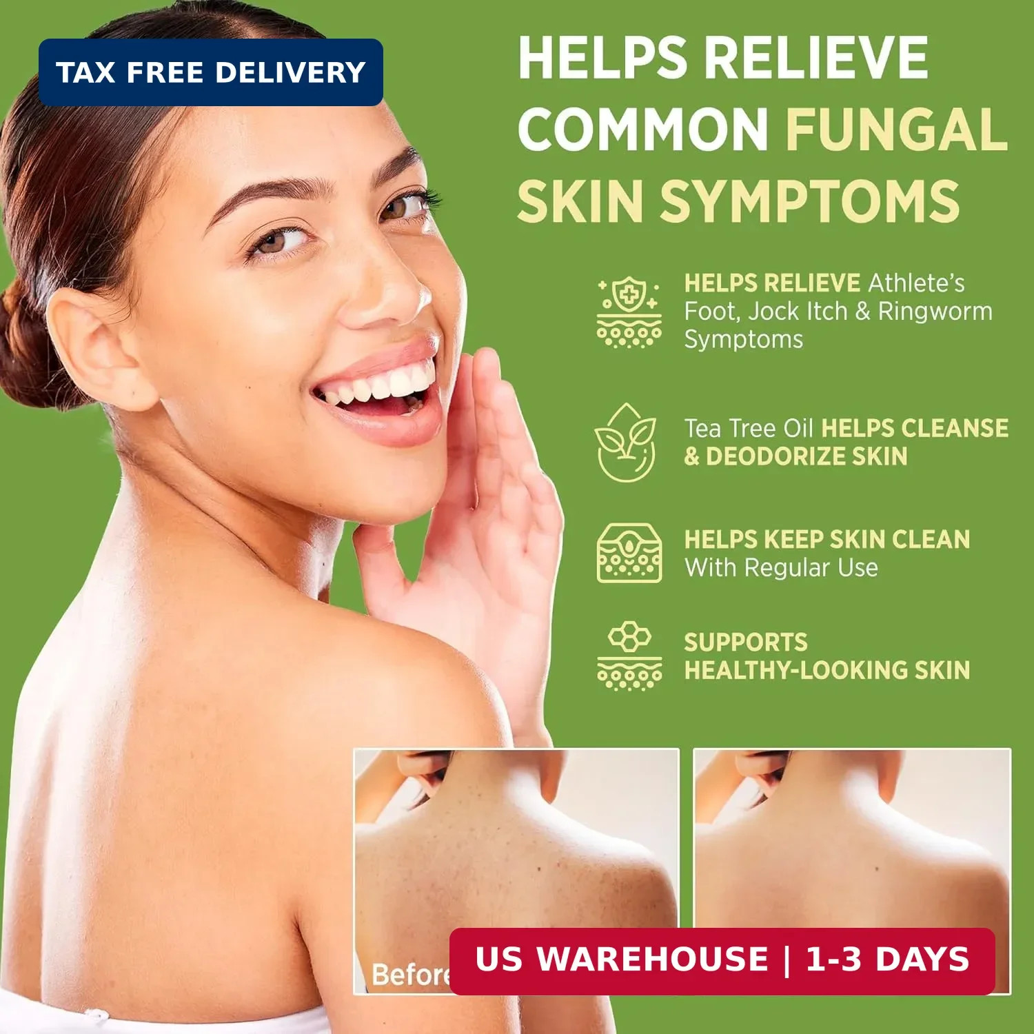 Roycederm Antifungal Bar Soap – Tea tree Oil Soap – Athlete’s Foot Treatment for