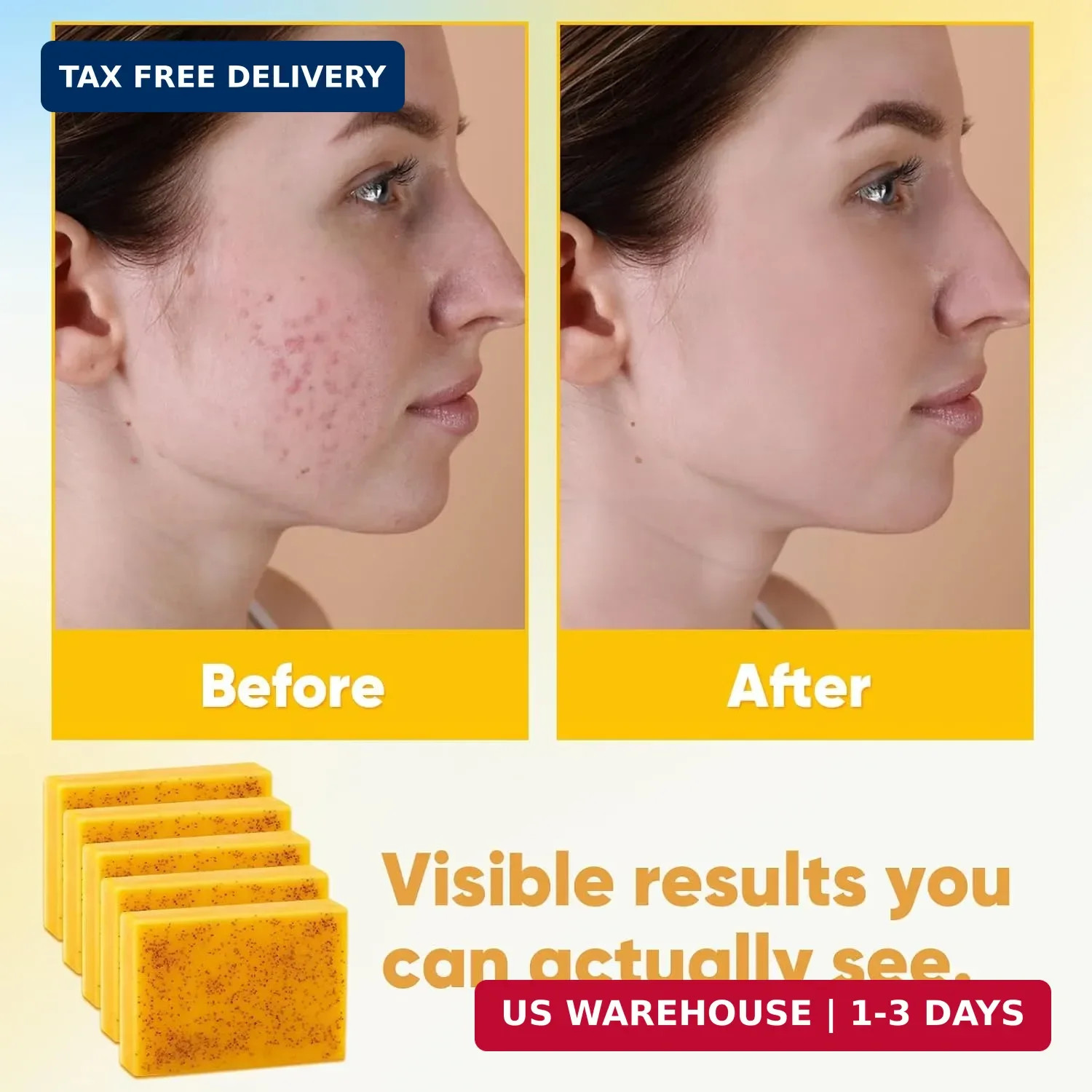 5 Jabones De Curcuma 3.5 Oz Para Las Manchas El Acne En La Cara Y Aclarar Piel