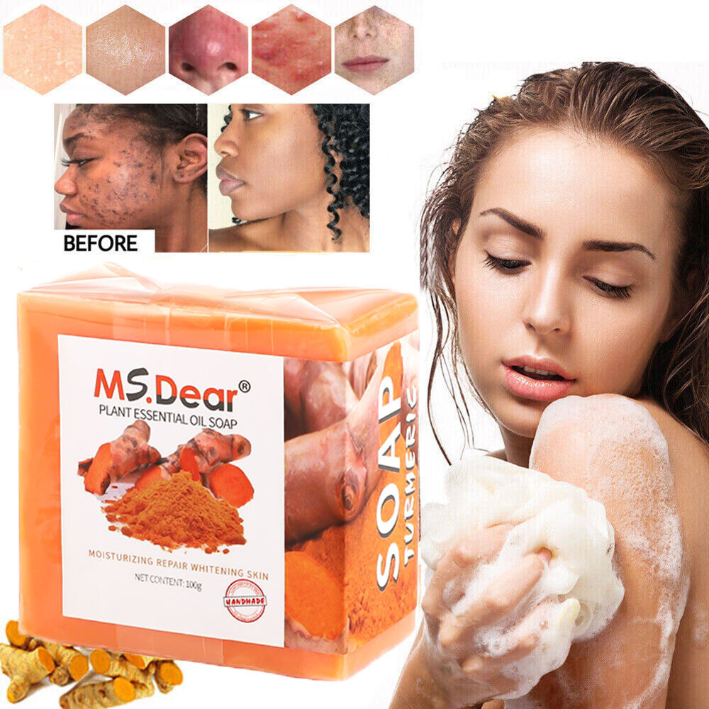 3/1x Tumeric Soap Skin Whitening Dark Spots lightening Acne Brightening Turmeric