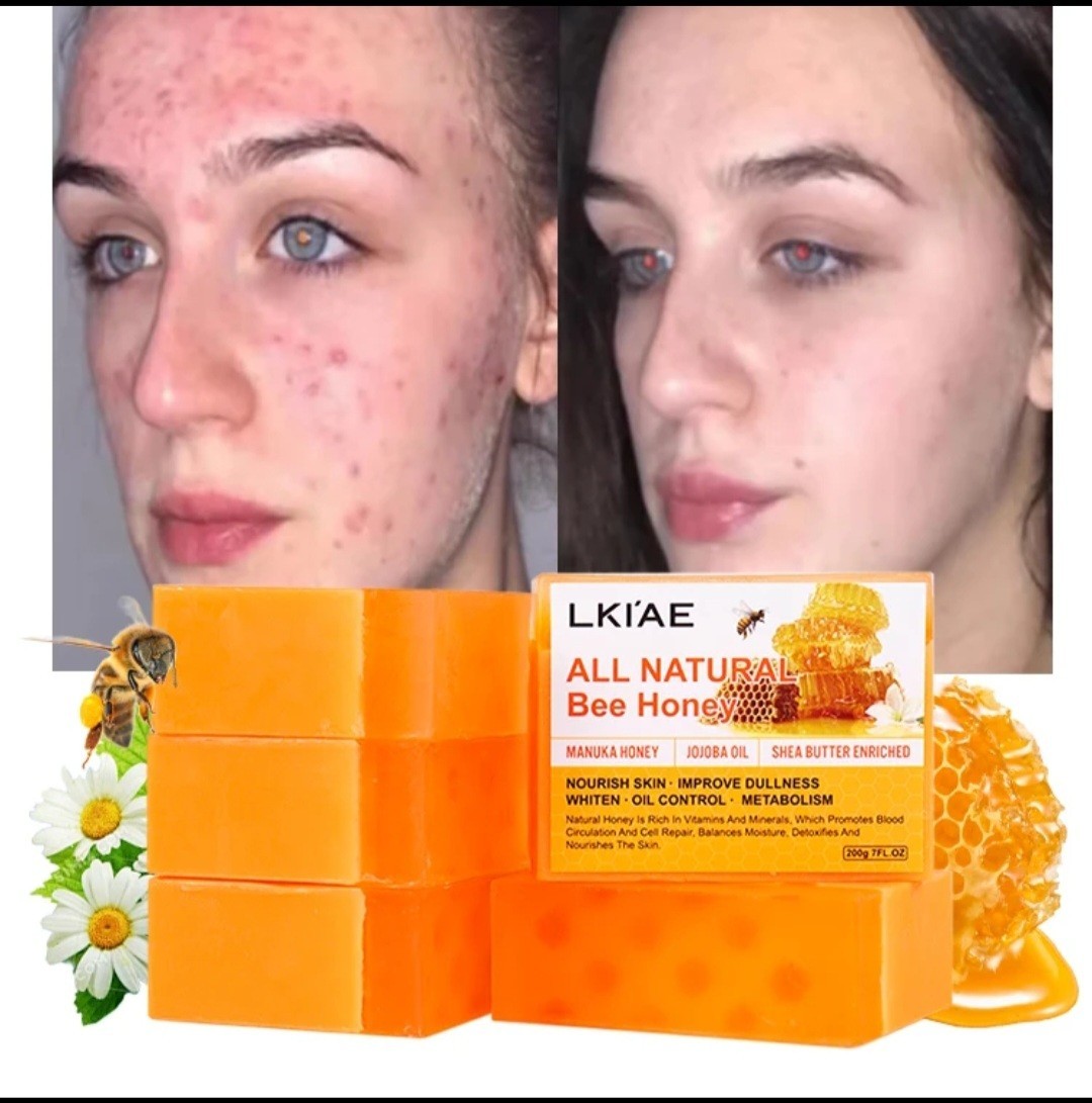 SanLimit Serum and Bee Honey Soap Lot of 2 Set Serum 4.2 Fl Oz, And Soap 7fl oz