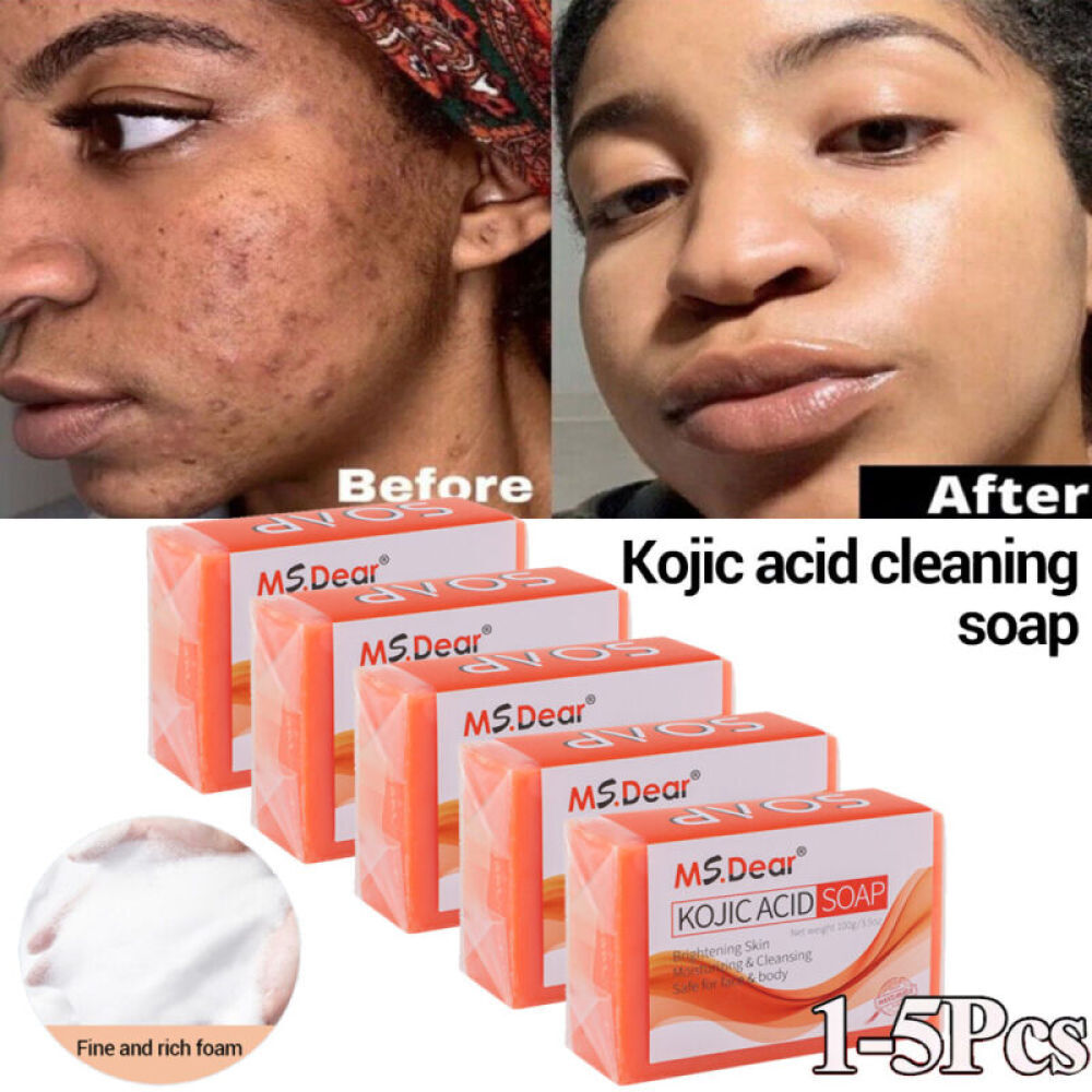 Kojic Acid Soap Dark Skin Whitening Bleaching Lightening Brightening Face & Body