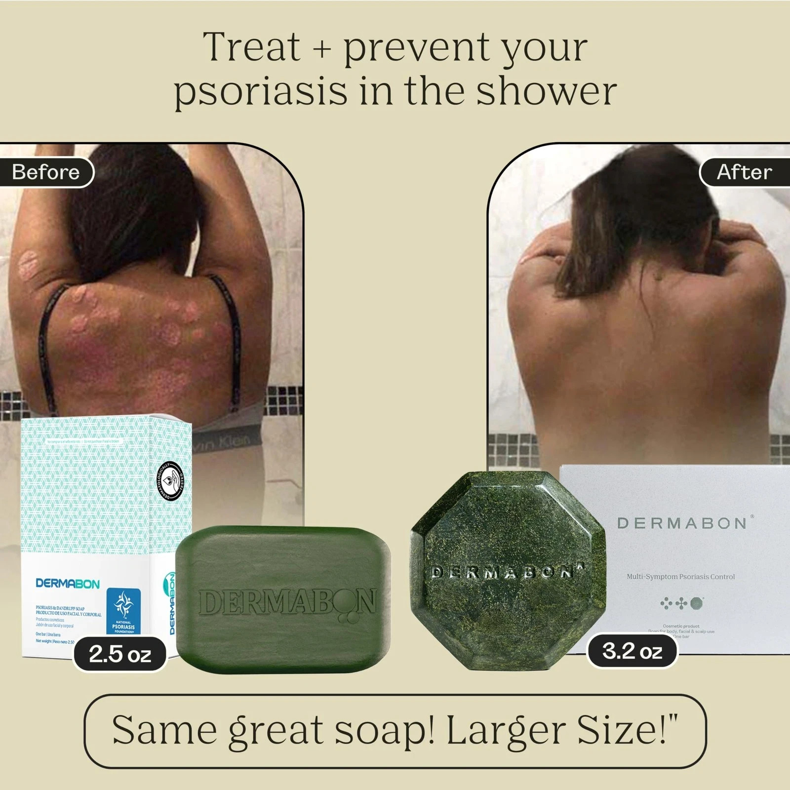 Dermabon Psoriasis Cleanser, Seborrheic Dermatitis Eczema Soap Bar for Adult…