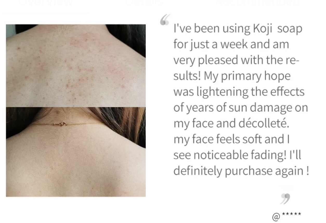 original kojie san kojic acid soap, Lightening Anti-Acne Kojic Acid Soap 100g