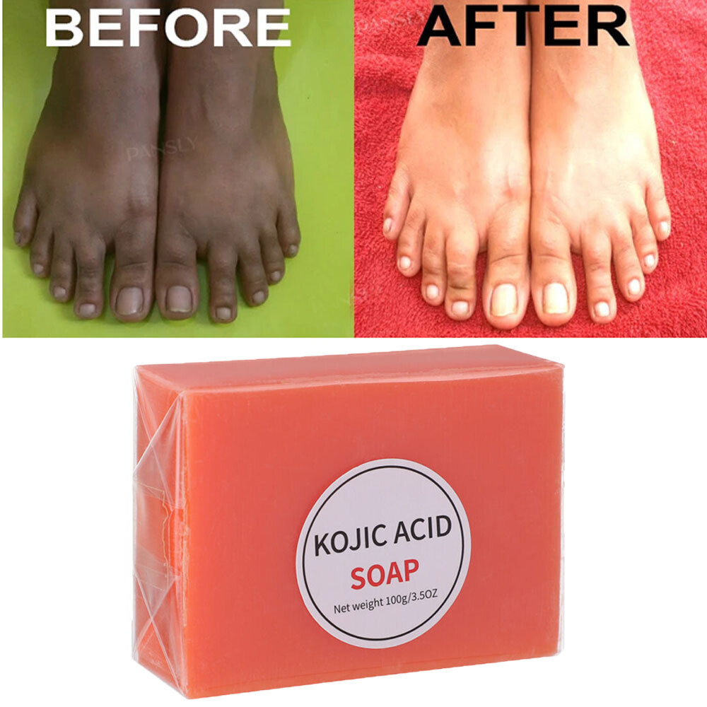 KOJIC Acid Face Body Cleanser Soap for Dark Spots Skin Lightening & Whitening