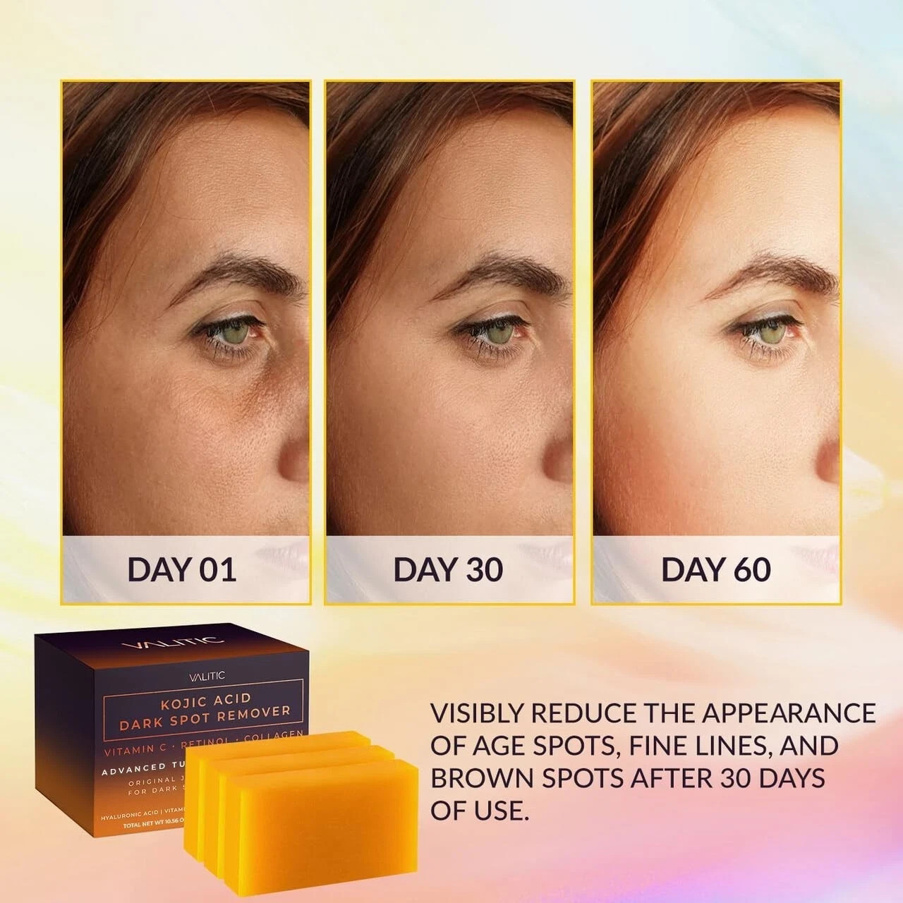VALITIC Kojic Acid Dark Spot Remover Soap Bars with Vitamin C, Retinol, Collagen