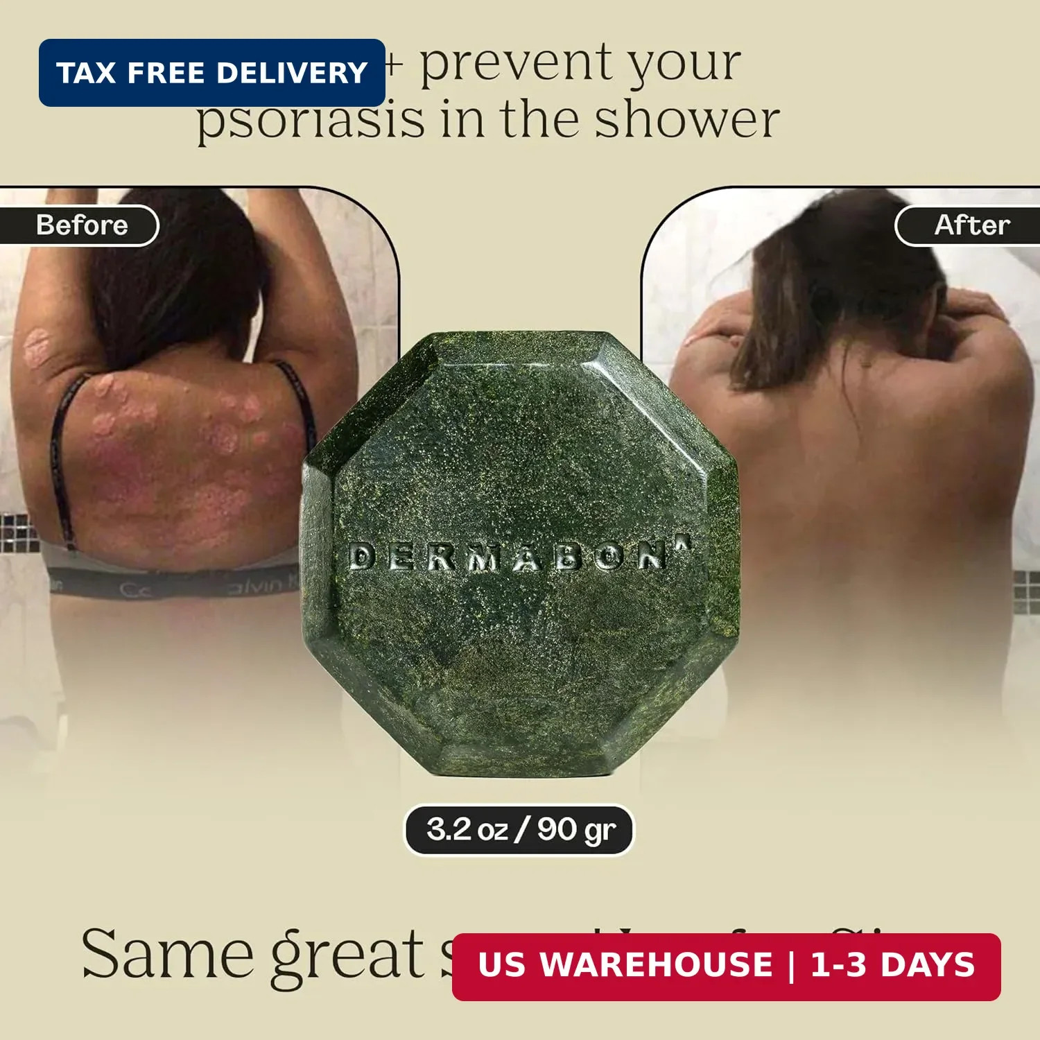 Dermabon Psoriasis, Dermatitis & Dandruff Control Soap Bar with 2% Coal Tar as A