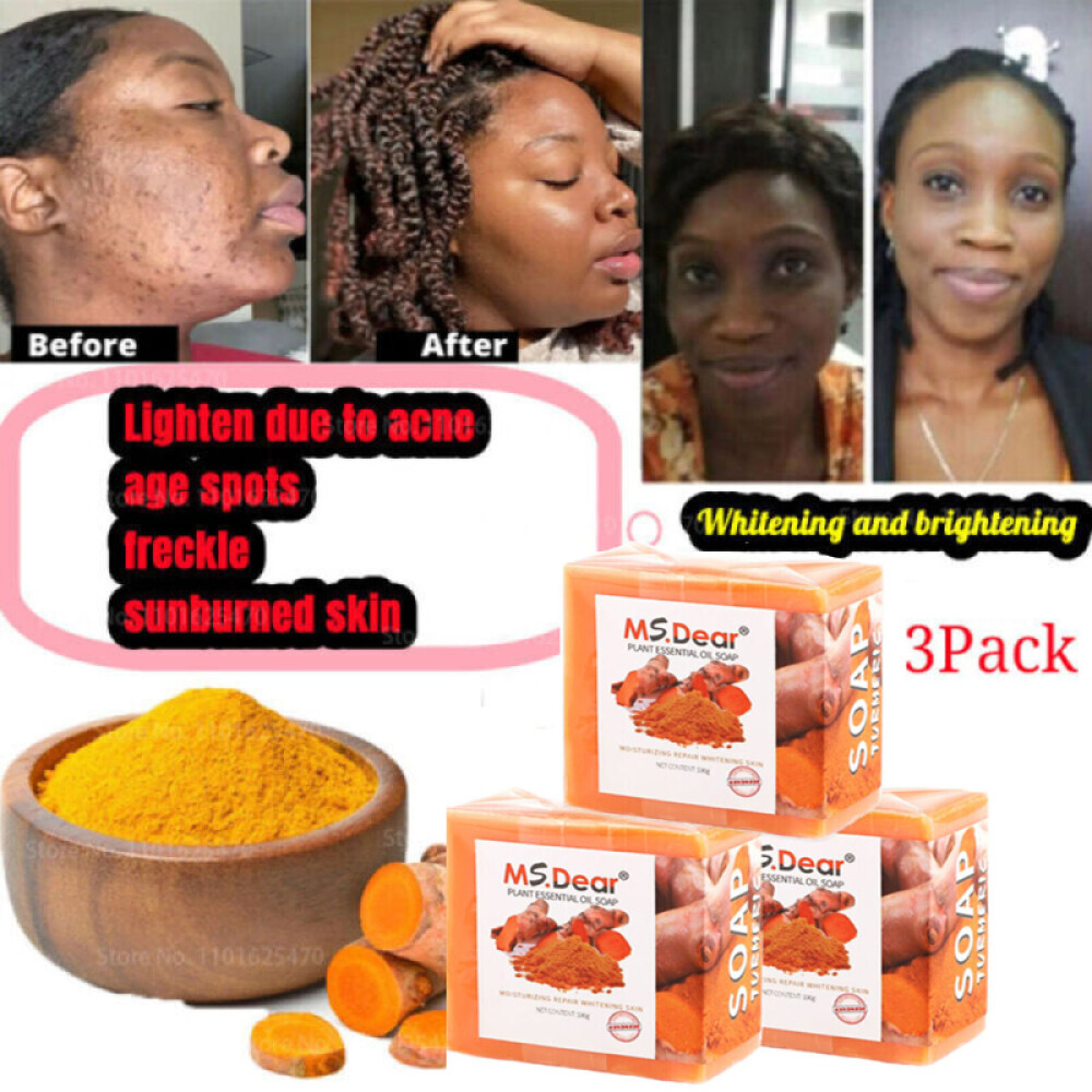 3PCS Tumeric Soap For Dark Spots, Skin Lightening, Anti Acne Skin Cleansing Soap