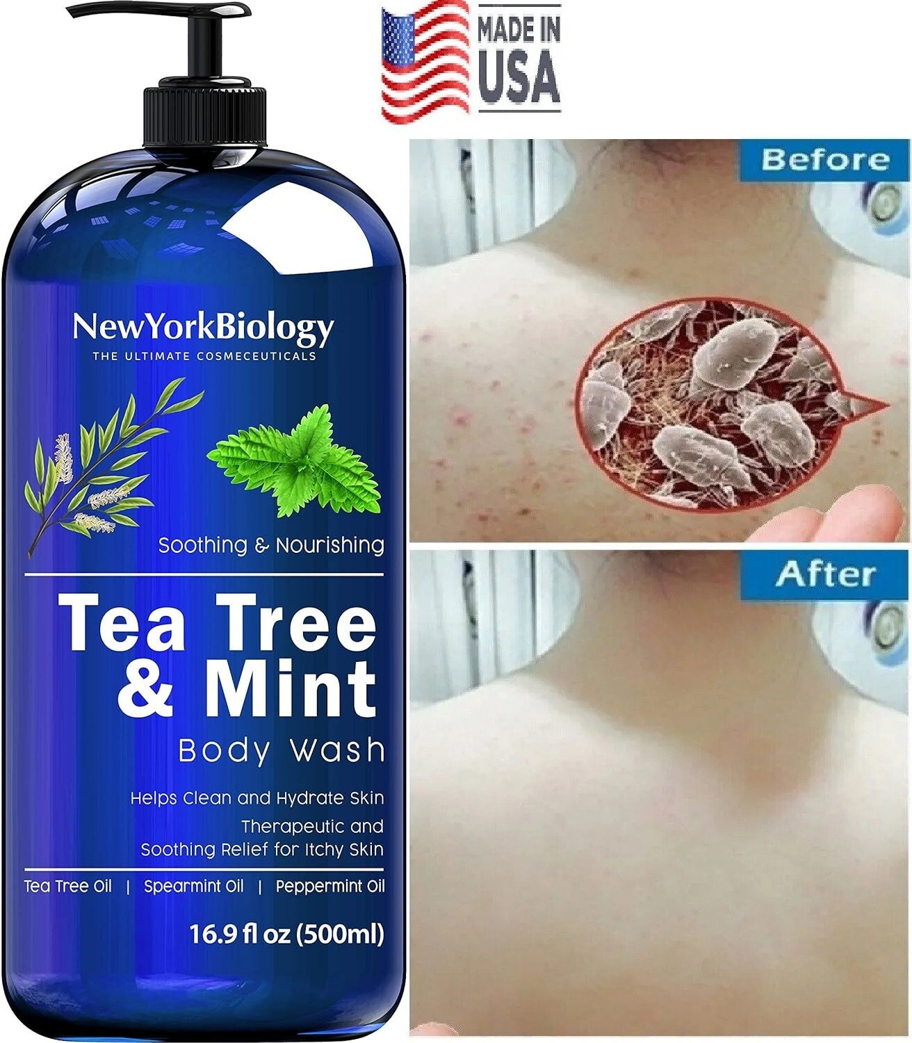 Therapeutic Soap Antifungal and Antibacterial Body Eliminate Fungus Ringworm Acn