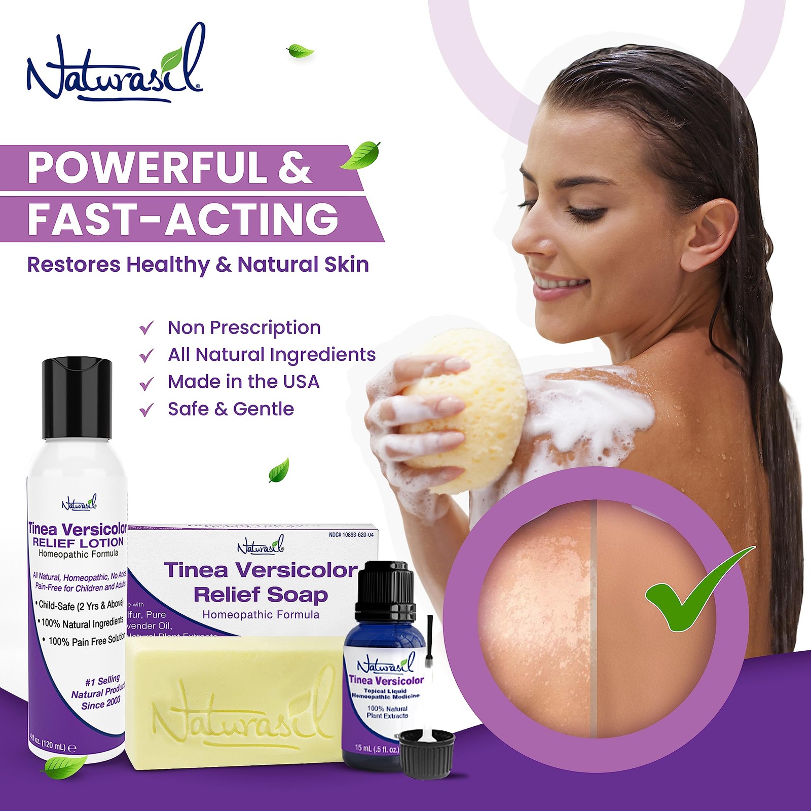 Naturasil Tinea Versicolor Soap Natural Skin Care for Itching Irritation 4oz